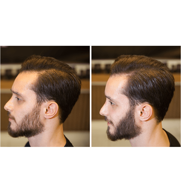 Fixbeard Sakal Dolgunlaştırıcı | Siyah