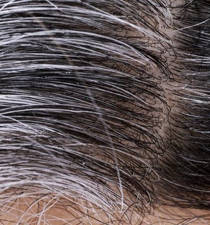 Saçlar Neden Beyazlar ?